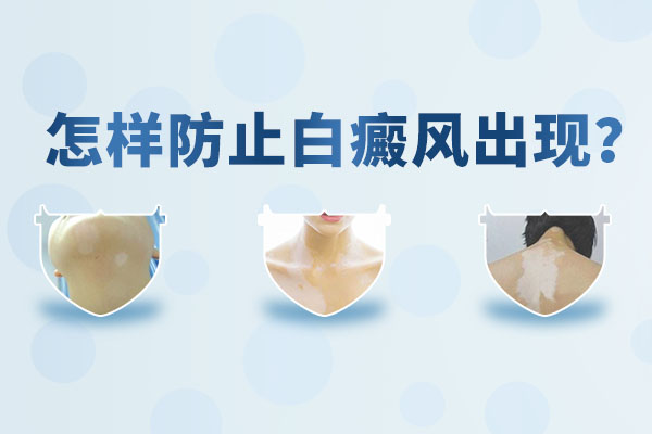 如何預(yù)防白癜風(fēng)比較科學(xué)呢？