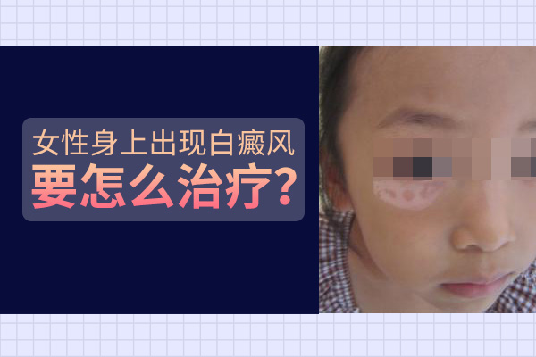 女孩子臉上長(zhǎng)塊白癜風(fēng)要怎么處理呢？