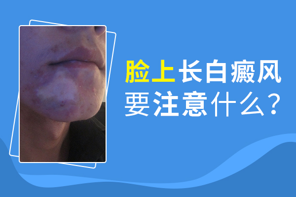 臉部白癜風患者應(yīng)該怎么護理呢？