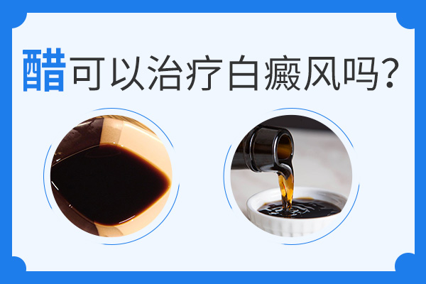 喝醋真的能夠治療白癜風(fēng)嗎？